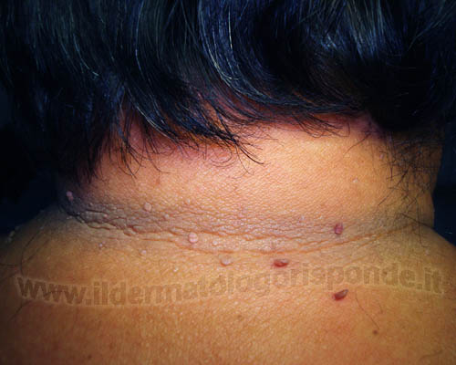 Le creme da pigmentary notano in farmacie