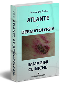 atlante di dermatologia online con immagini cliniche