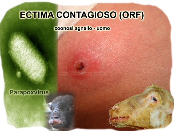 Ectima contagioso ORF