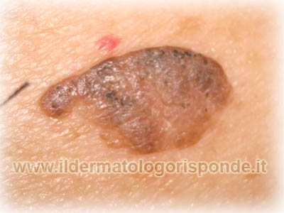 esami_dermatologia