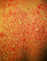 Dermatologo Dott. Del Sorbo Risponde il Dermatologo Dott. Del Sorbo
