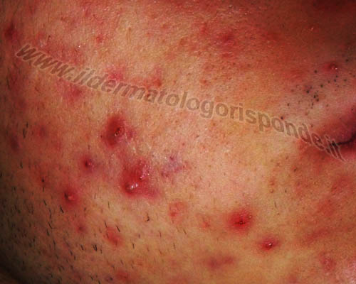 esami diagnostici in dermatologia e venereologia