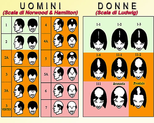 alopecia tricogramma salerno