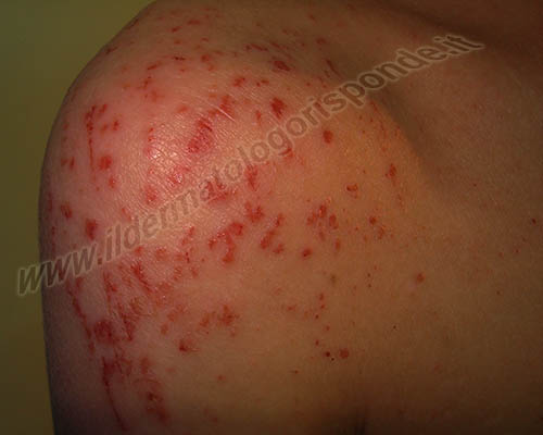 dermatologia olistica dermatologia olistica, omeopatia e fiori di Bach