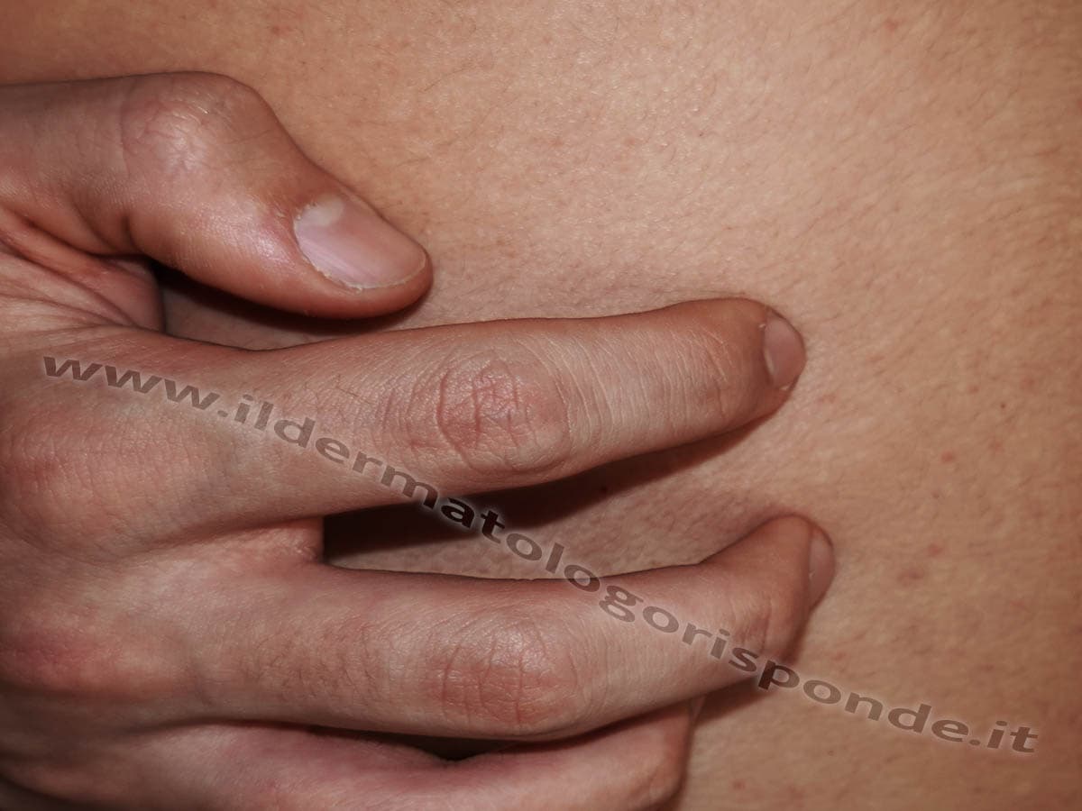 Prurito Dopo La Doccia Da Cosa Dipende