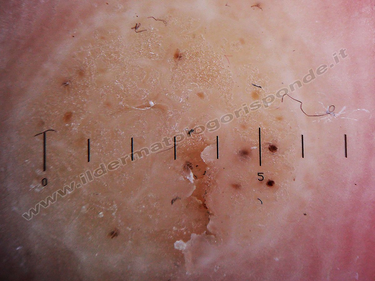 Verruche Amico Pediatra