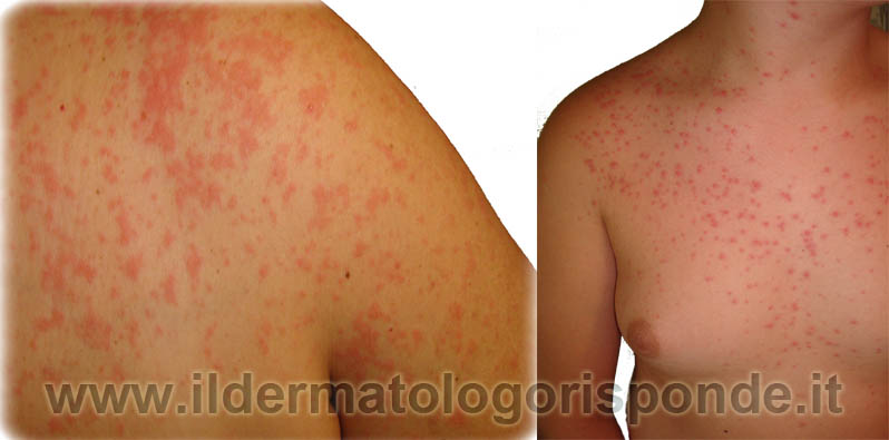 dermatologia_pediatrica